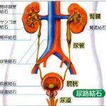 人生2回目の尿路結石になって死ぬほど痛かった。。